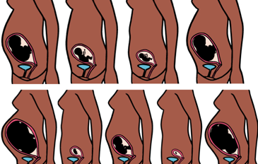 Thumb grossesse